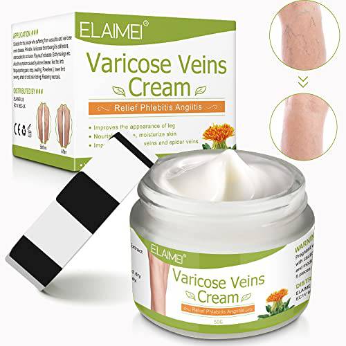 ALIVER Varicose Veins Cream, Spider Varicose Vein Treatment Cream For Legs, Improve Blood Circulation, Pain and Itching of Legs Fast Relief, Anti Varicose Vein Soothing Leg Cream (1.76 OZ)