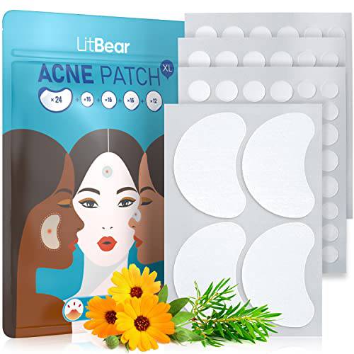 LitBear Acne Pimple Patches, 5 Sizes 84 Patches for Large Zit Breakouts, Acne Patches for Face, Chin or Body, Acne Spot Treatment with Tea Tree & Calendula Oil, Hydrocolloid Bandages for Acne Skin