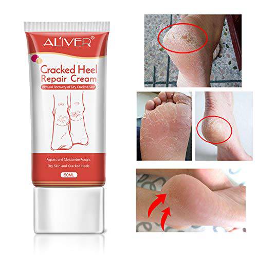 Cracked Heel Cream, Foot Moisturizer, Foot Callus Remover Foot Skin Whitening Repair Cream, Softens And Intensively Hydrates For Thick, Cracked, Rough, Dead and Dry Feet Skin