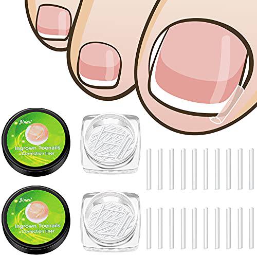 100 Pieces Ingrown Toenail Corrector Strips Toenail Correction Patches Curved Toenails Straightening Recover Clips Thick Paronychia Pedicure Tool Toenail Straightener Strip for Men Women Foot Care