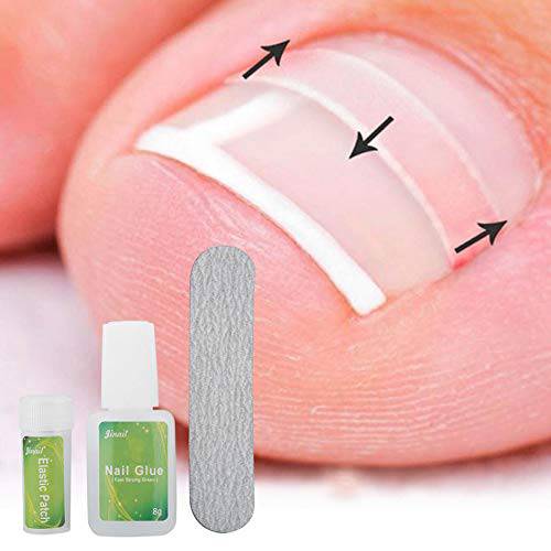 12pcs Ingrown Toenails Patch Correction Tool Kit Set Ingrown Toe Nail Pedicure Elastic Patch Straightening Clip Brace with Glue
