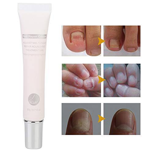 Nail Repair Cream, 20ML Nail Cream Repair, Nail Strengthener, Finger Toe Nail Care Cream for Men and Women Home Use